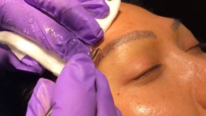عملية تجميل الحواجب في تركيا