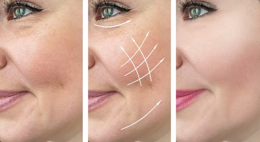 عمليات تجميل الوجه